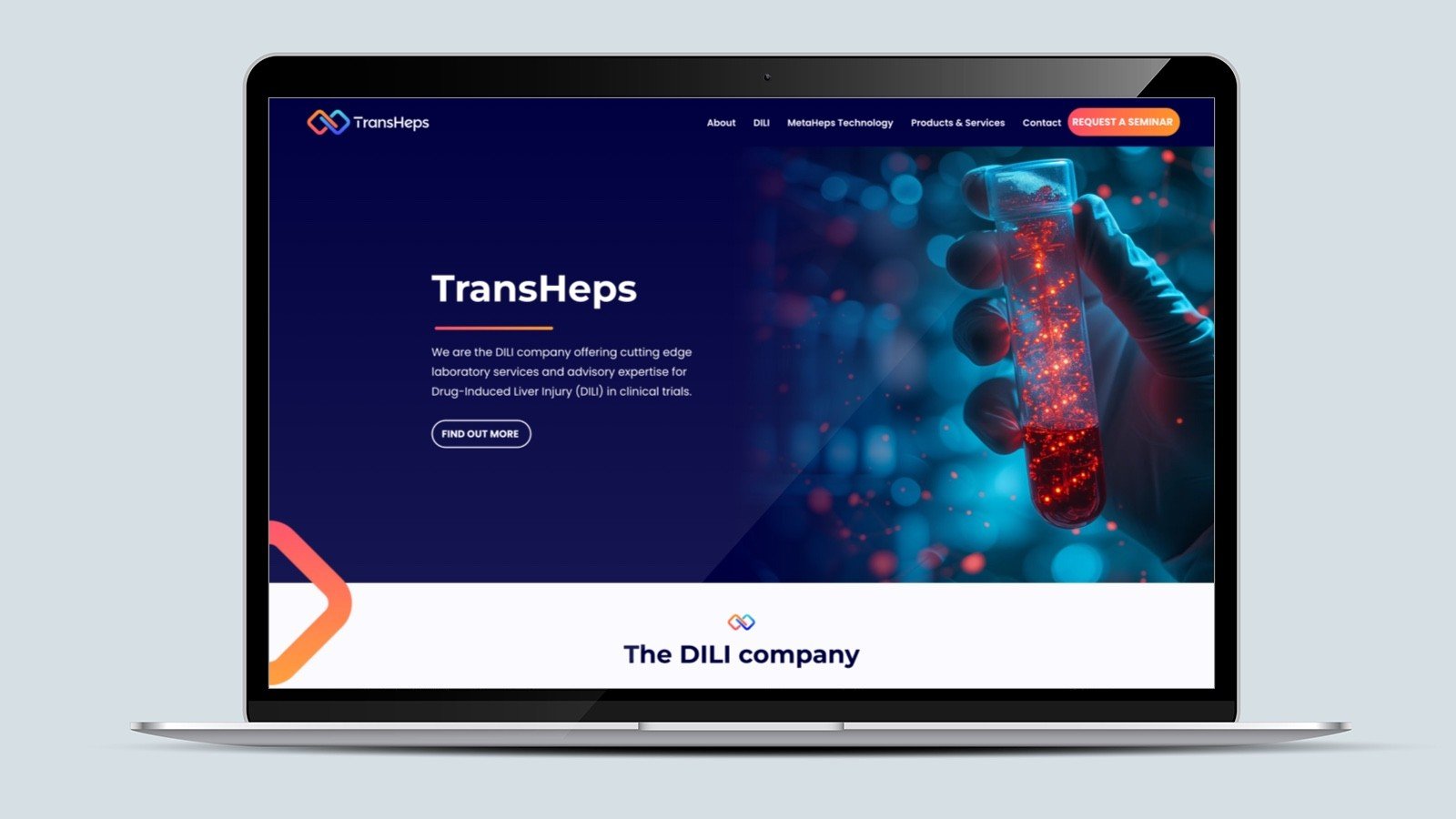 Screenshot of the TransHeps homepage on a laptop